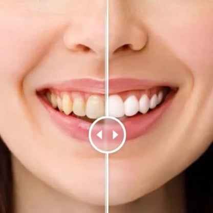 Feimuko Shito™ TikTok・Instagramで話題｜販売数No.1