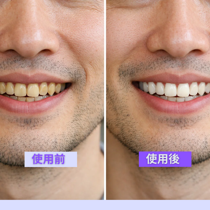 Usonic™ TikTok・Instagramで話題｜販売数No.1